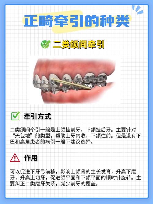 正畸Bolton的临床意义在临床实践中如何具体体现？-图2
