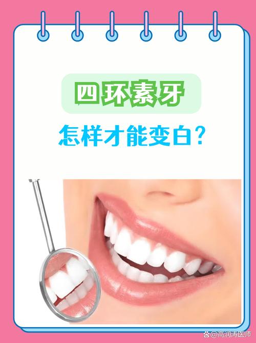 四环素牙如何自我美白?实用方法有哪些?-图2 四环素牙如何自我美白?实用方法有哪些?-图2