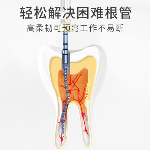 根管机扩m3使用方法有哪些关键步骤？-图3