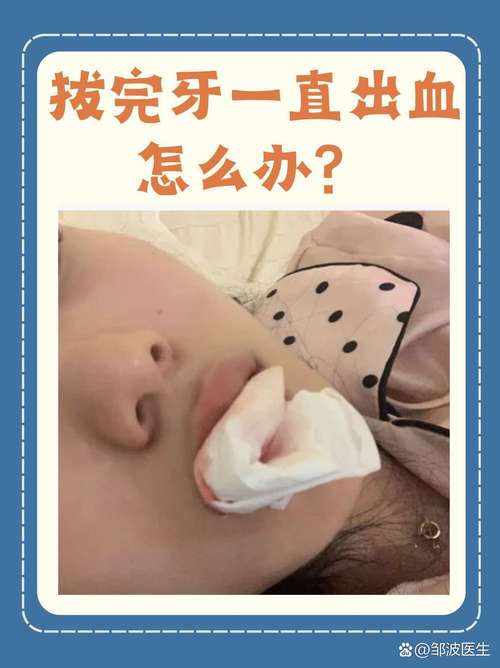 种牙后大量出血如何正确处理？-图2