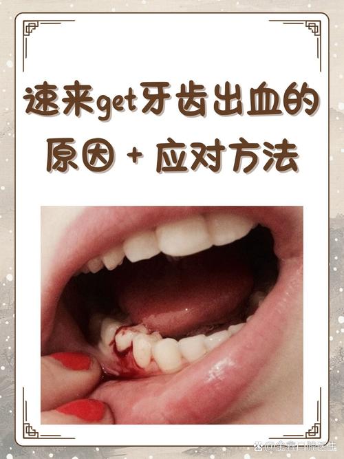 种牙后大量出血如何正确处理？-图1