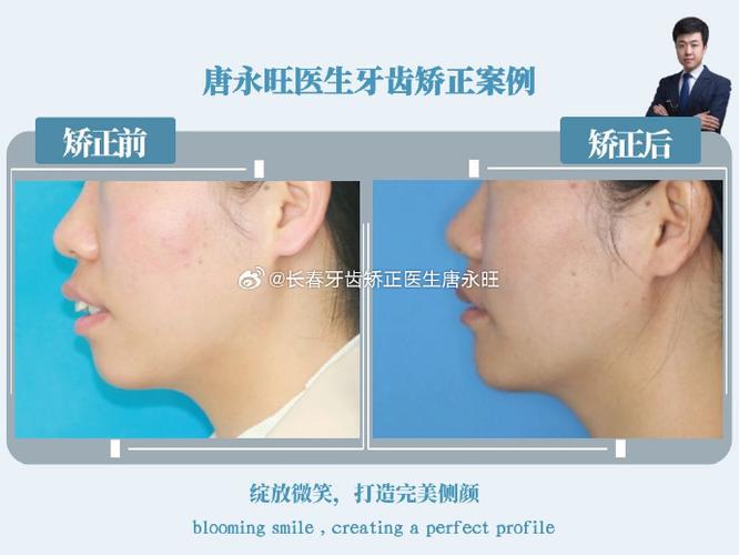 主治医师矫正进修一年半，技能提升效果如何？-图1