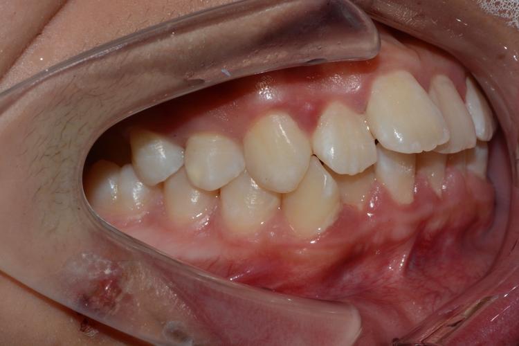 中国医科大学正畸视频，正畸效果如何保障？-图2