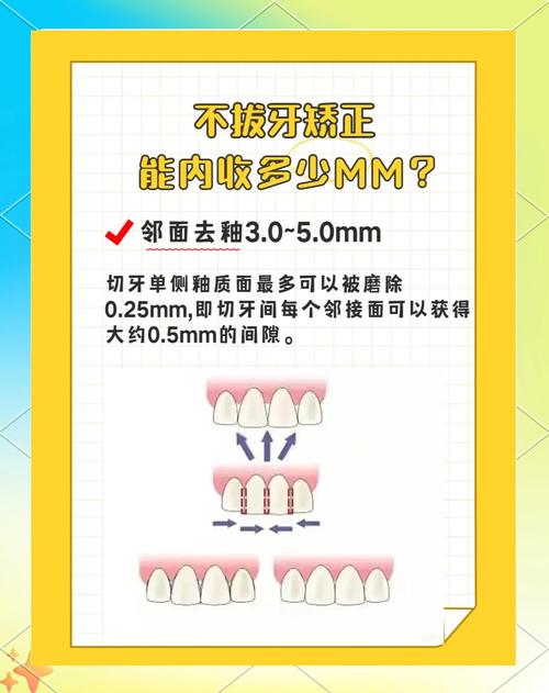 口腔正畸一科与二科在诊疗重点、技术特色及患者选择上有何具体差别？-图2