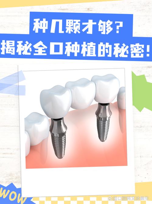 嘉兴种植牙去哪里种好？靠谱医院怎么选？-图2