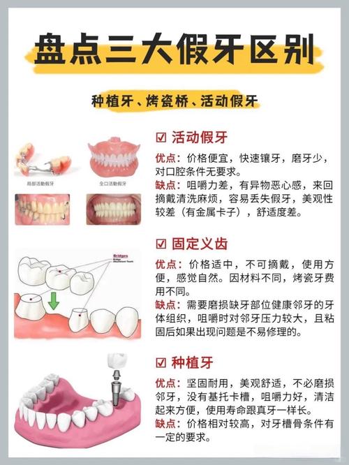 瑞典镶牙VS种牙，哪个更好？优缺点对比如何科学选？-图1