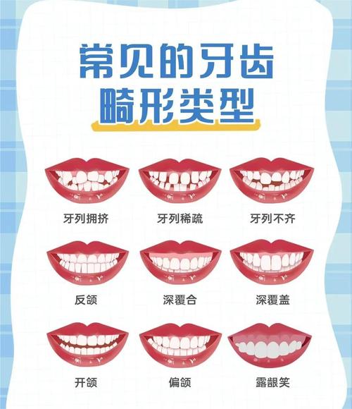 牙的分类方法具体有哪几种类型？-图2