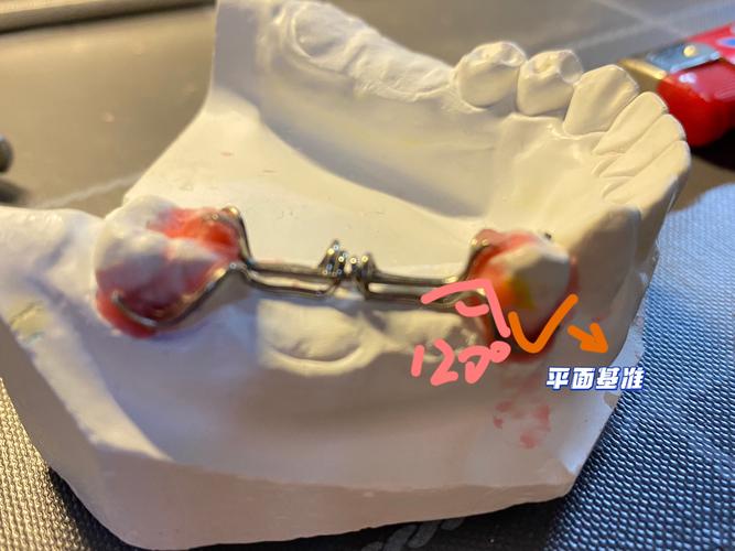 如何弯制三臂卡环？图谱方法步骤有哪些？-图2