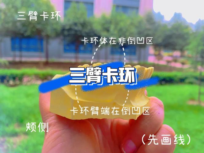 如何弯制三臂卡环？图谱方法步骤有哪些？-图1