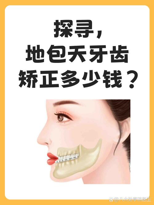 上海地包天正畸要多少钱-图1 上海地包天正畸要多少钱-图1
