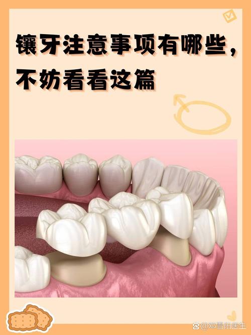 镶牙后能拔掉种牙吗？-图1