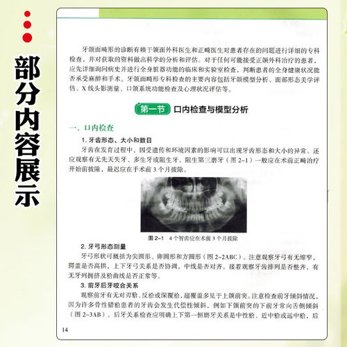 骨性错颌畸形的治疗方法有哪些？-图3