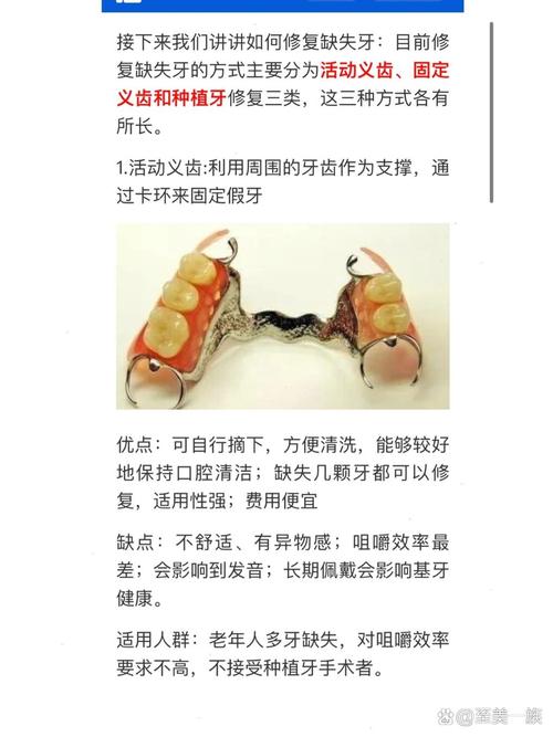 缺半个牙修复的几种方法-图2