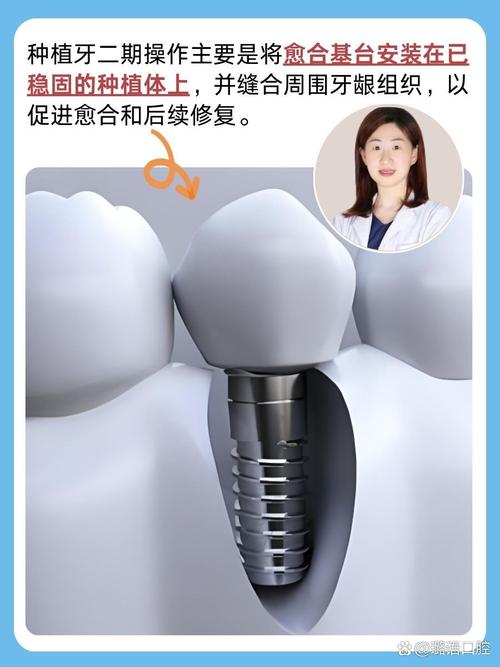 种牙后旁牙紧是怎么回事?原因探究-图3 种牙后旁牙紧是怎么回事?原因探究-图3