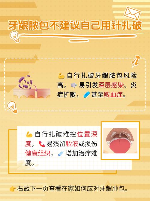 牙龈炎前期有哪些治疗方法？早期牙龈炎如何科学干预？-图2