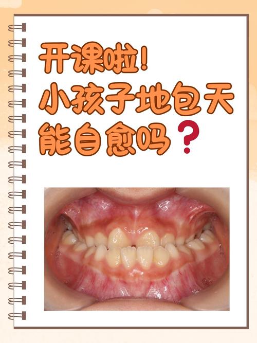 儿童治疗反合有几种方法-图1