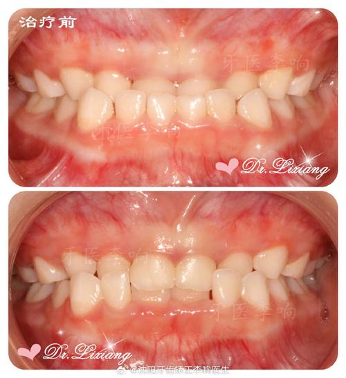 儿童治疗反合有几种方法-图2