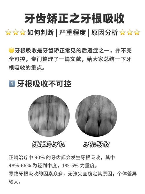 牙槽骨吸收后，还能种牙吗？-图1