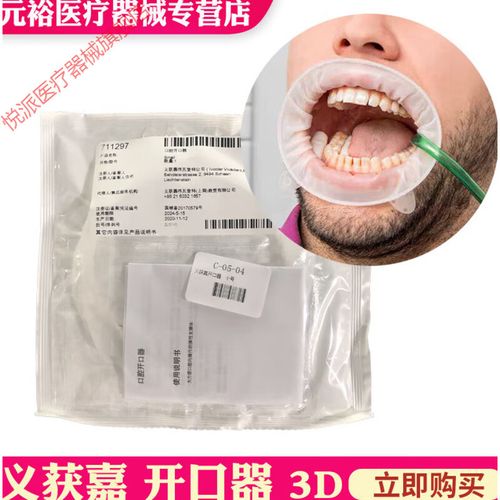 义获嘉开口器的使用方法-图3