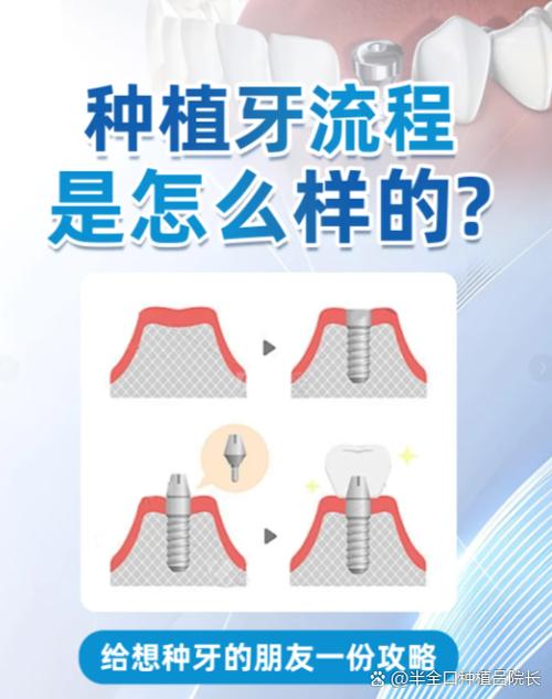 缺牙后种牙好还是牙冠好?哪种修复方式更适合?-图1 缺牙后种牙好还是牙冠好?哪种修复方式更适合?-图1