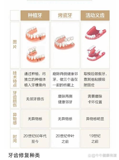 微创种牙与种植牙有何不同？-图1