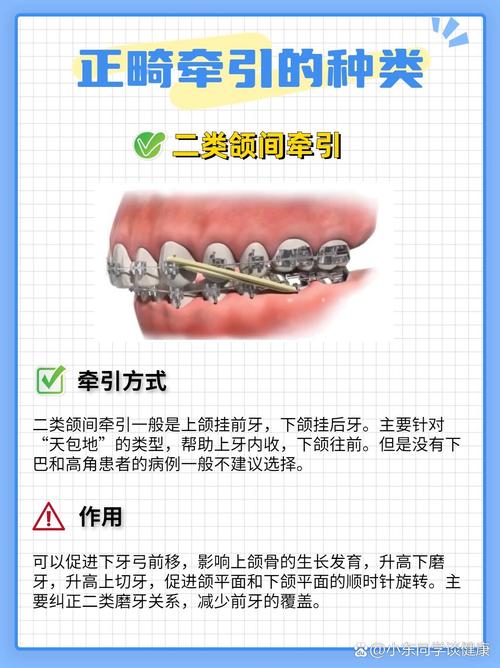 正畸橡皮筋一般需要多长时间更换一次？更换频率高效果更好吗？-图3