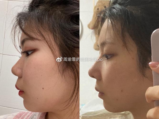 杭州去格莱美种牙的交通路线和就诊流程是什么？-图2