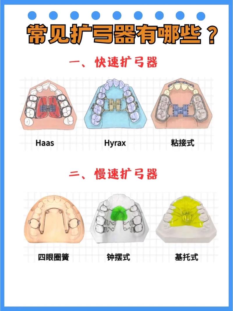 弯制正畸矫治器实验总结-图2