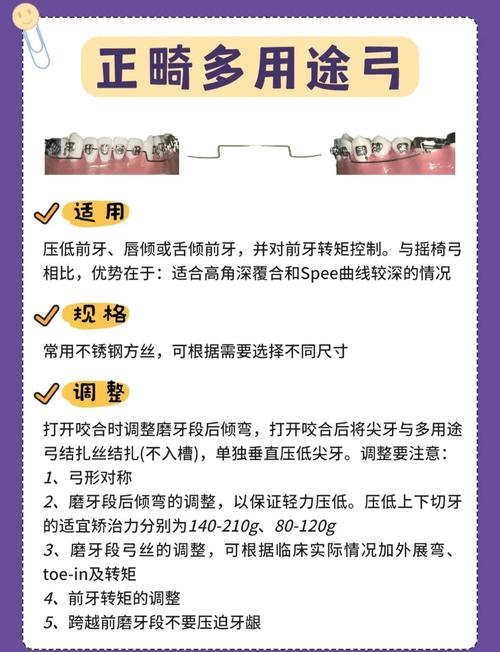 正畸妙弓弯制方法视频,如何正确弯制妙弓?-图2 正畸妙弓弯制方法视频,如何正确弯制妙弓?-图2