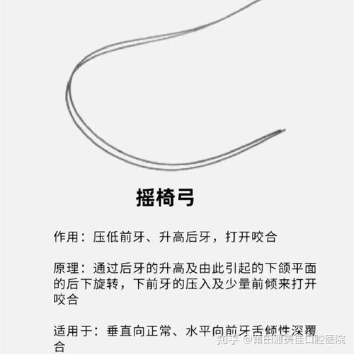 正畸妙弓弯制方法视频,如何正确弯制妙弓?-图3 正畸妙弓弯制方法视频,如何正确弯制妙弓?-图3