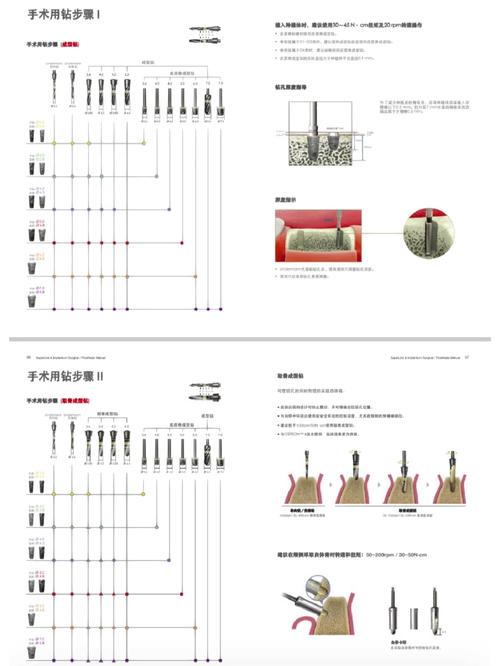 登腾种植工具盒的使用方法具体包括哪些步骤？如何正确操作？-图1