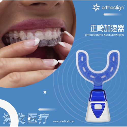 美速达正畸加速器价格是多少？-图1