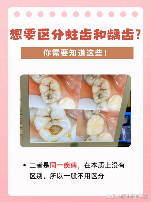 口腔有坏牙为何会影响种牙?-图1 口腔有坏牙为何会影响种牙?-图1