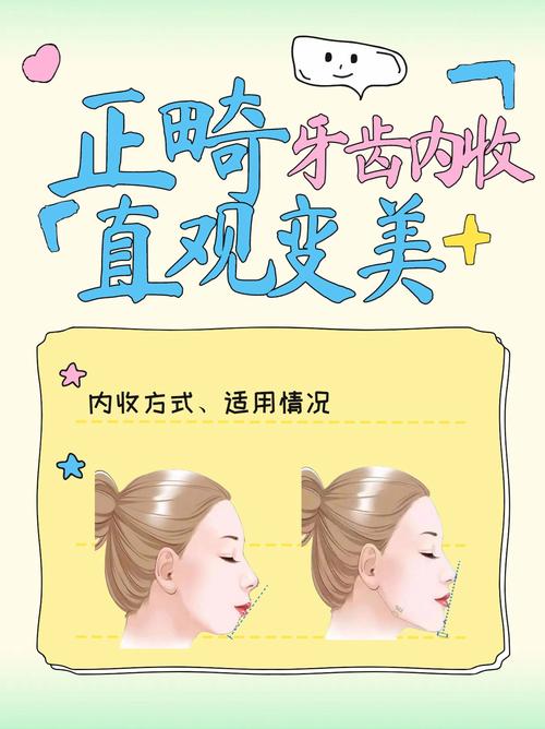 怎么改变突牙？有哪些矫正方法？-图3