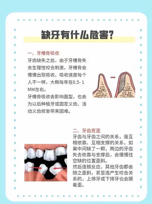 全口牙缺失种植牙风险高吗？这些隐患你必须知道！-图2