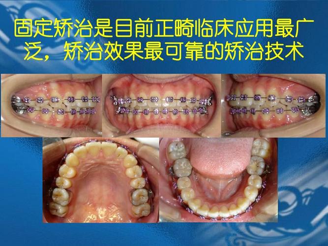 中华口腔正畸学杂志9月正畸临床与研究方向有何新动态？-图2