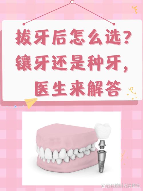 30岁种牙好还是镶牙好-图3