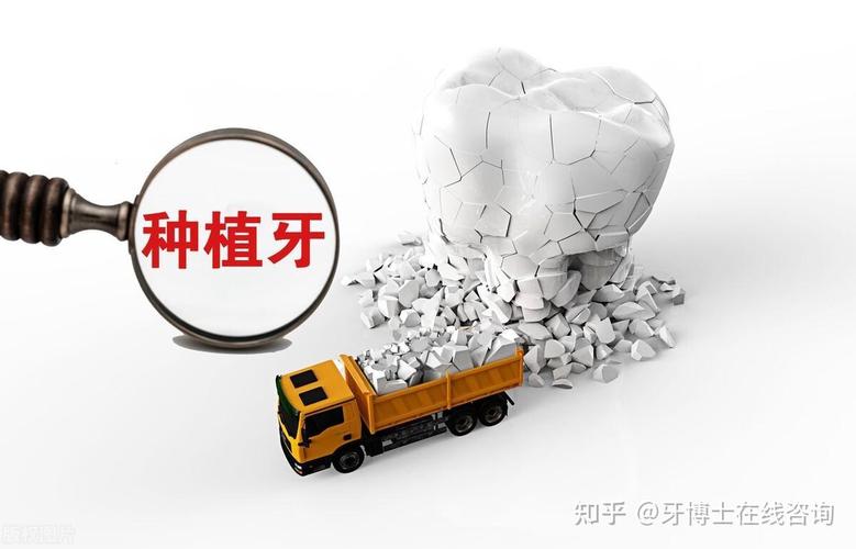 即拔即种牙一颗价格是多少？-图2