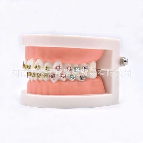 正畸颊面管使用方法图片有哪些操作步骤？-图3