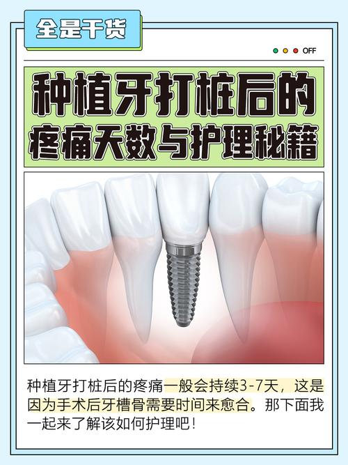 种牙一期后一般疼几天-图1