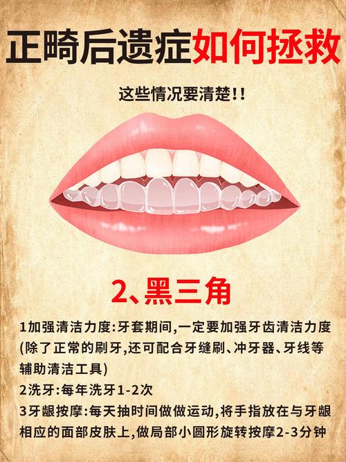 正畸完成后为什么会复发-图1