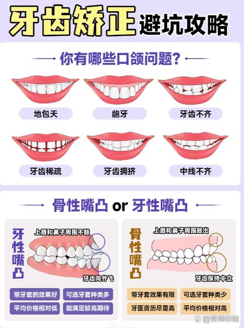 不带牙套绞正牙齿的方法-图2