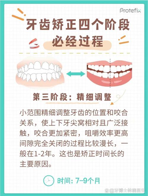 正畸中2火4技术具体指什么？-图1