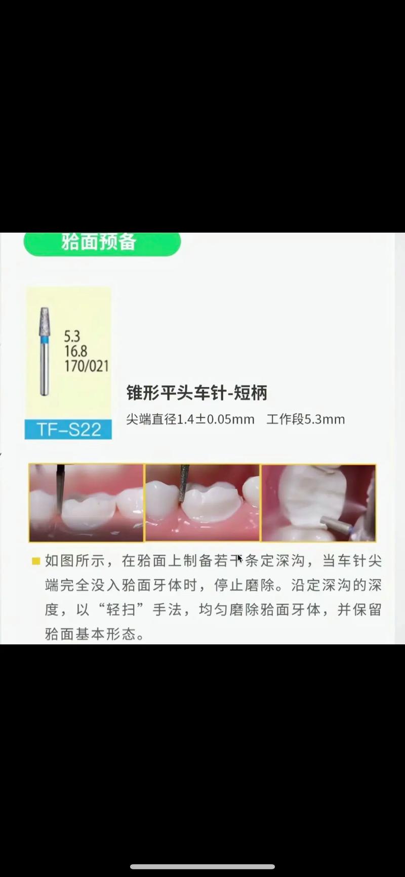 牙体预备光滑连续的方法-图1