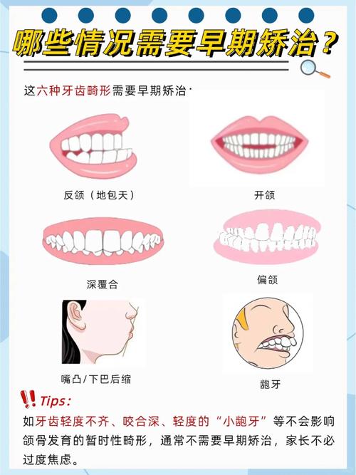儿童最好的牙齿矫正方法-图2