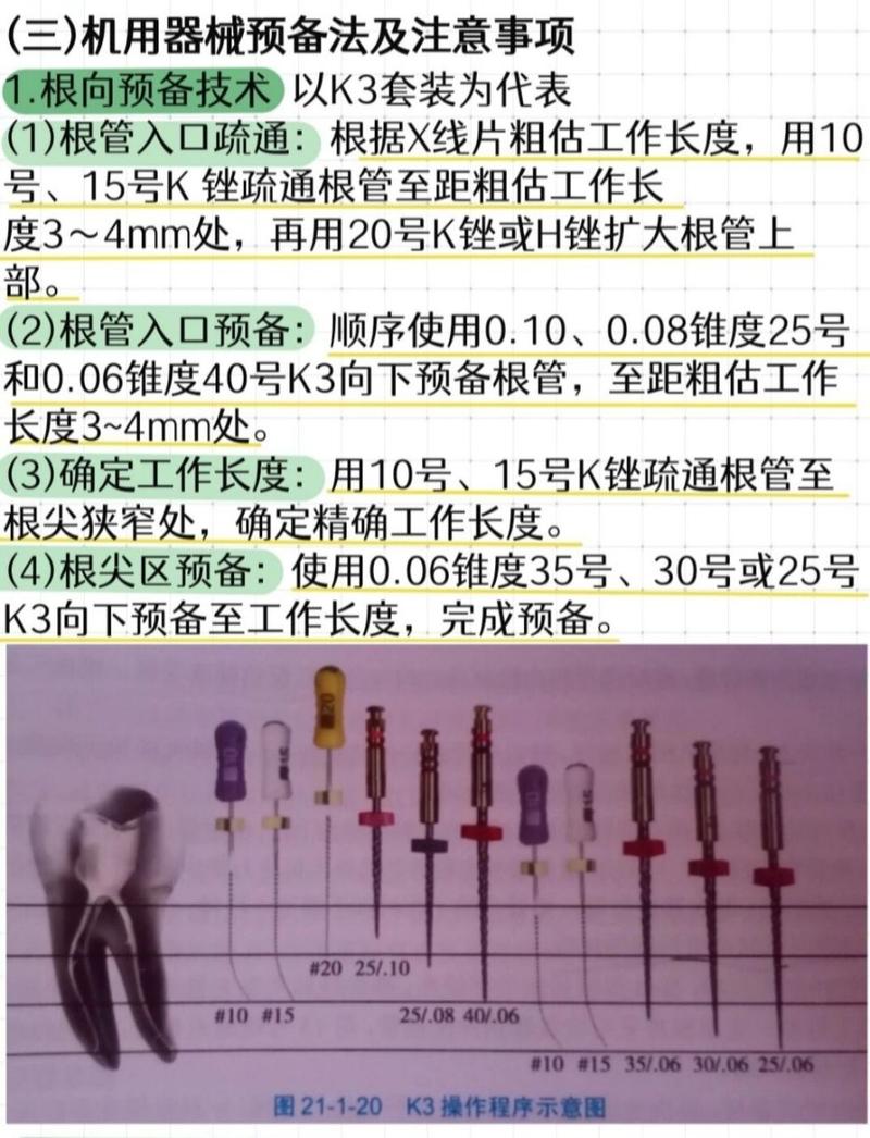 大锥度根管治疗预备方法-图2