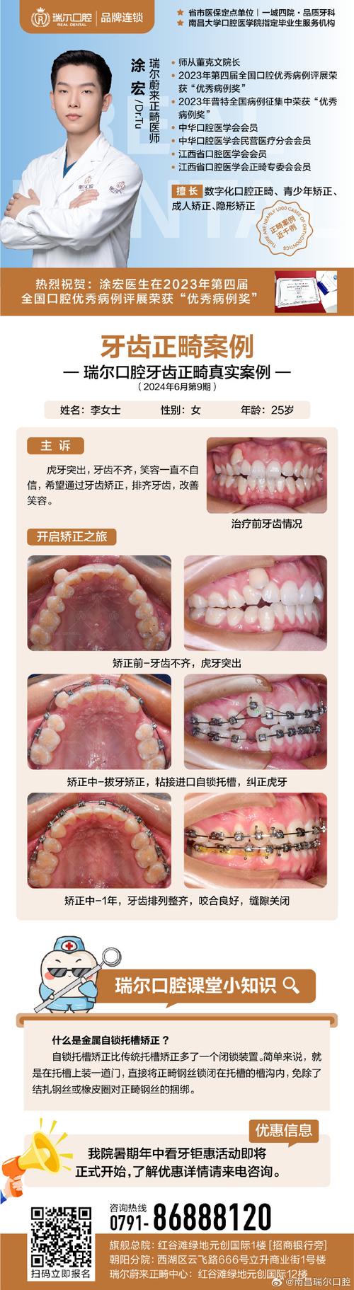 口腔正畸疗效评价标准网的标准如何规范统一临床疗效评价？-图2