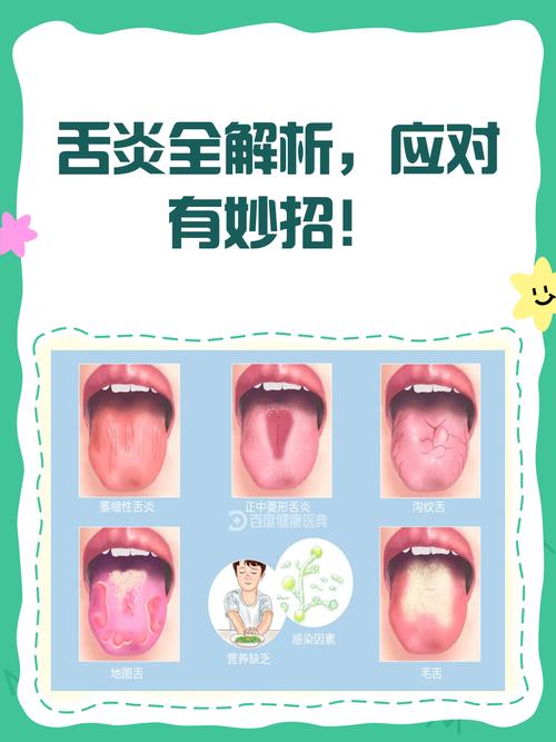 中医治疗舌炎的最佳方法-图2