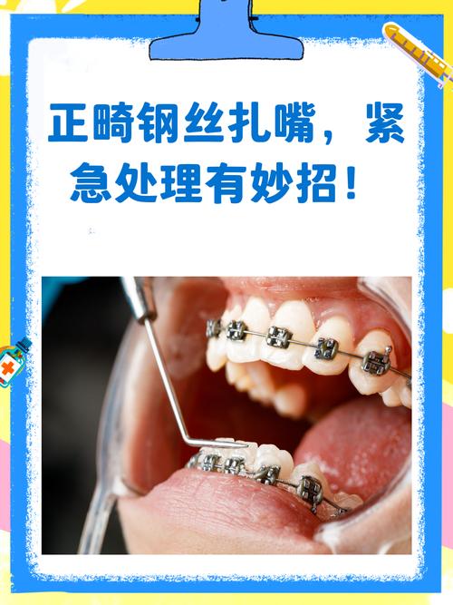 8字结扎法正畸效果如何？操作难点与优势在哪？-图3