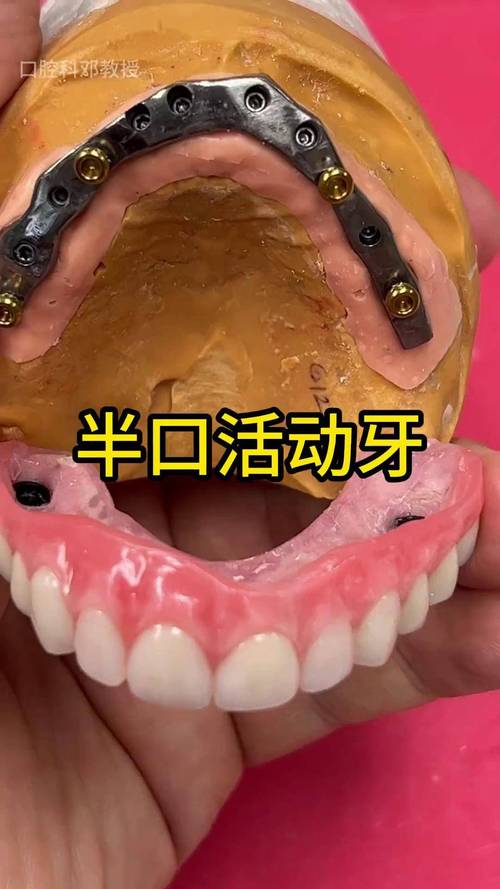 活动假牙戴牙方法视频，正确佩戴步骤是怎样的？-图2